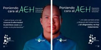 PONIENDO CARA AL ANGIOEDEMA HEREDITARIO